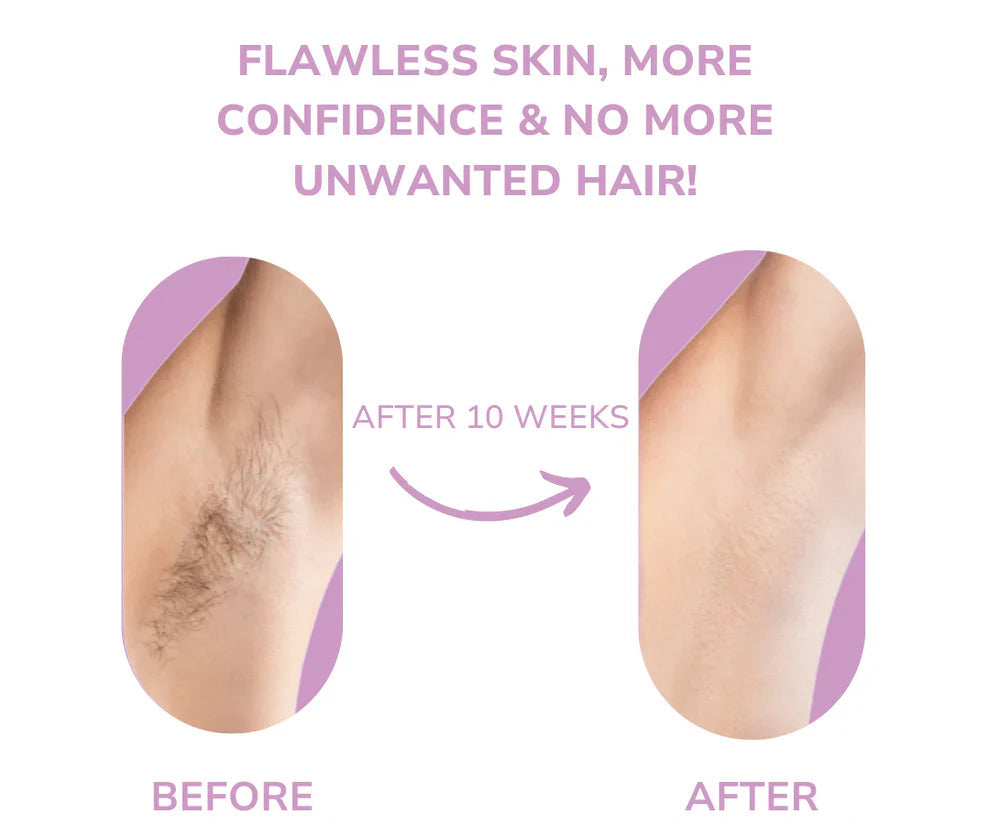 Ruvorae - IPL Hair Remover