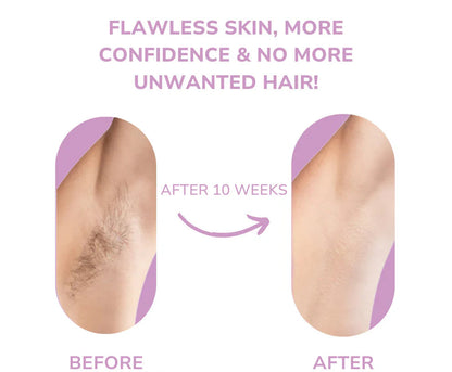 Ruvorae - IPL Hair Remover