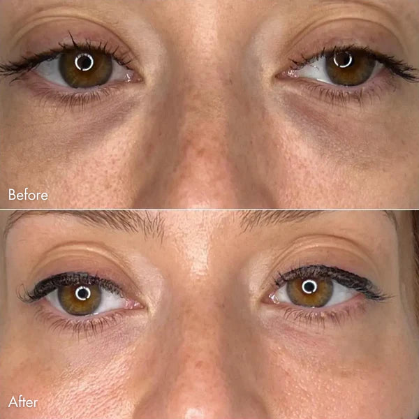 Ruvorae - Eye Glow Patches