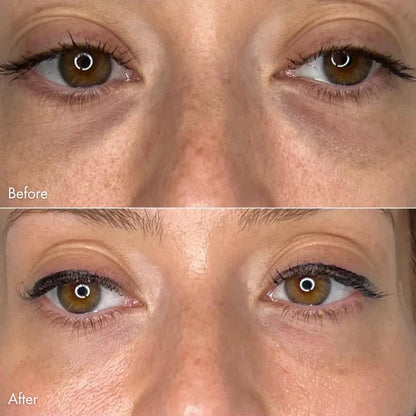 Ruvorae - Eye Glow Patches