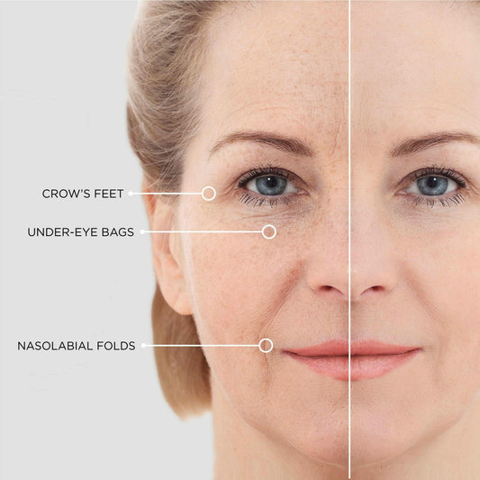 Ruvorae - Eye Glow Patches